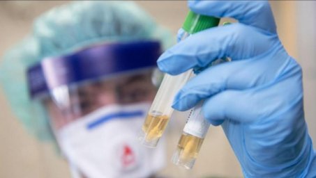 В Мостовском районе выявлено двое новых заболевших коронавирусом